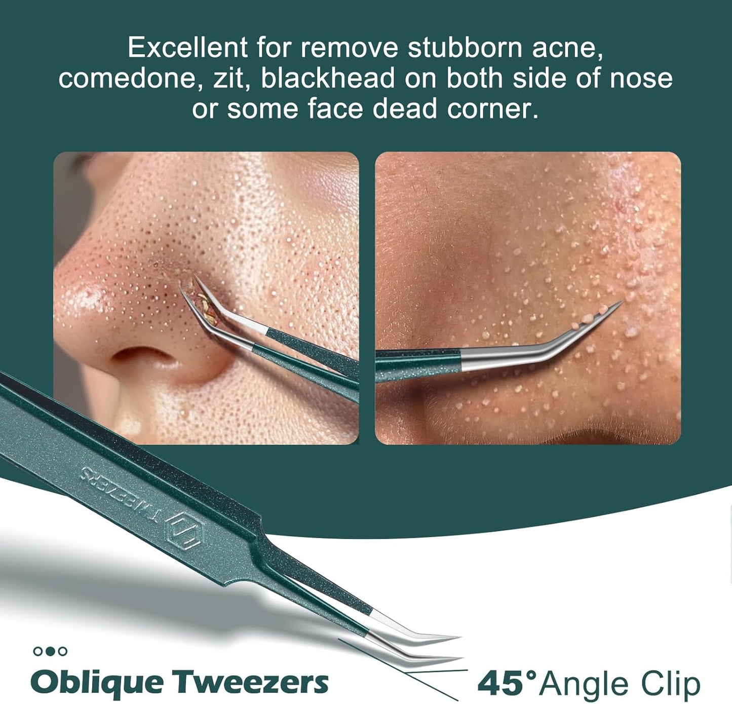 WSYUB Blackhead Tweezers,Upgrade Professional Facial Blackhead Remover Tweezers, Extraction Tools for Estheticians,Ingrown Hairs Tweezers