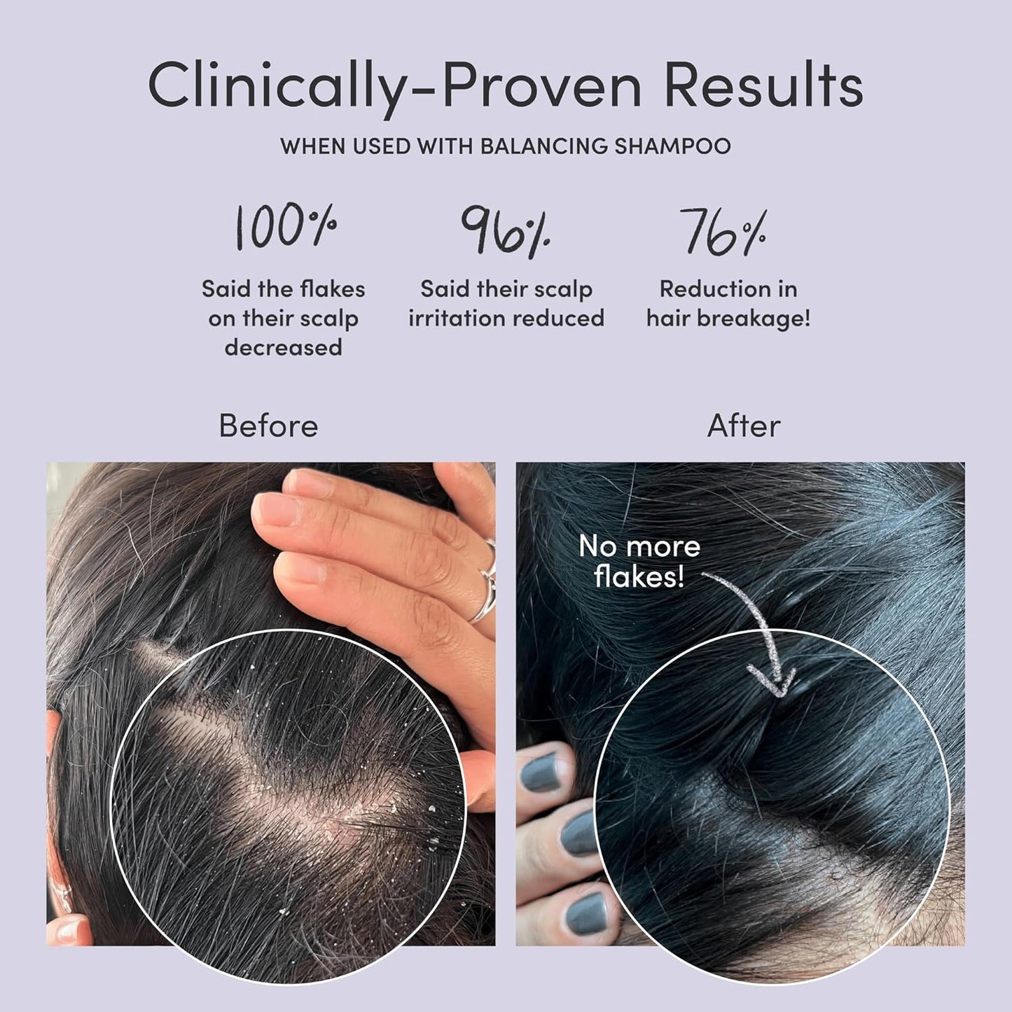 Jupiter Balancing Shampoo and Restoring Serum - Anti Dandruff Shampoo & Serum for Flaky, Itchy, Oily, & Dry Scalp - Nourishes Scalp, Reduces Breakage & Flakes - Color-Safe, Sulfate-Free, Paraben-Free