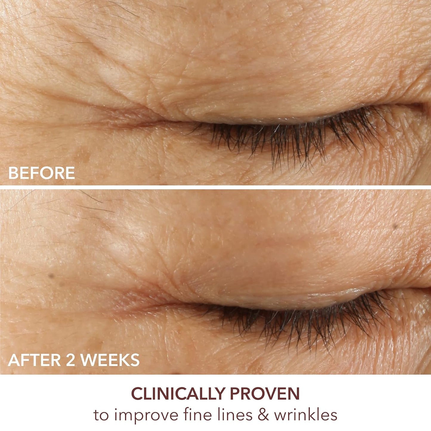 Dr. Dennis Gross Advanced Retinol + Ferulic Triple Correction Eye Serum | Firm Skin, Boost Hydration, and Reduce the Look of Wrinkles & Crepiness | 0.5 oz